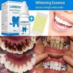 Lanbena teeth whitening essence: Buy at the Best price in Bangladesh - Image 2